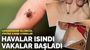 Yaz geldi kene vakaları arttı